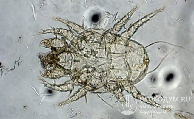На фото, сделанном под микроскопом, – подкожный клещ Sarcoptes scabiei